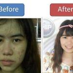 BHIP