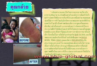 ผลลัพธ์จากผลิตภัณฑ์ Maqui berry